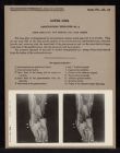 Lower Limb. Articulations. Knee-Joint - no. 3